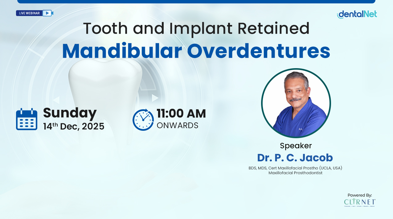 Tooth and Implant Retained Mandibular Overdentures